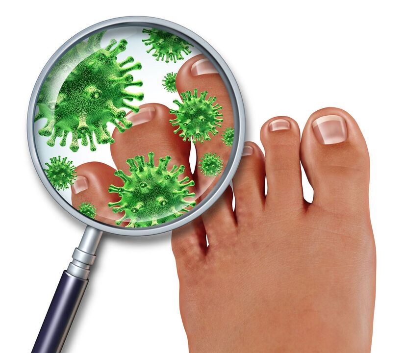 ¿De dónde vienen los hongos en las uñas de los pies 