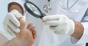El médico examina la pierna afectada por el hongo